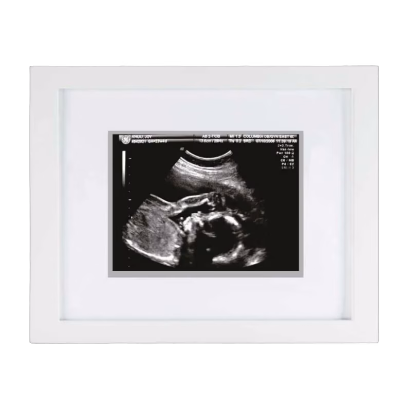 Pearhead Fotoram Ultraljudsbild (Vit)